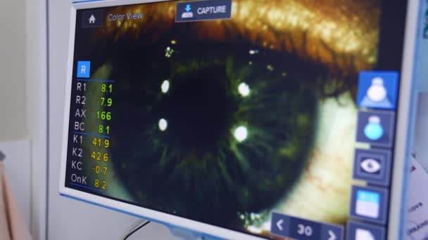 Μάτι Του Ασθενούς Στην Οθόνη Του Οφθαλμίατρου Εξέταση Ματιών Οθόνη — Αρχείο Βίντεο