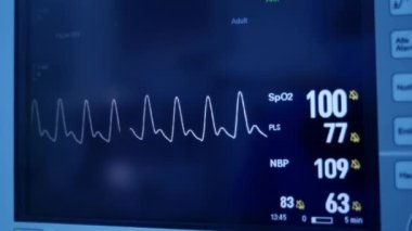 Kalp atış hızı monitörü. Ekran görüntüleme titreşim okumaları. Monitörde hastanın hayati belirtileri görülüyor. Tıbbi muayene. Kalp monitörü. Elektrokardiyografi.