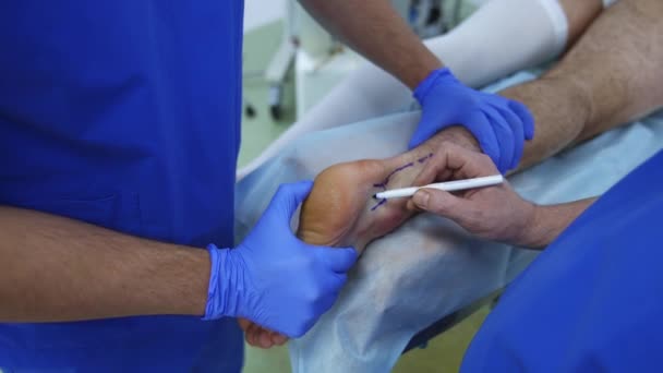 Pacientova Noha Chirurgickém Stole Chirurgové Připravují Nohu Před Operací Lékařský — Stock video
