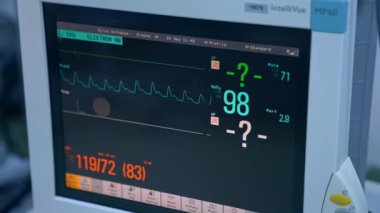 Kalp atış hızı EKG kardiyak monitörü. Kalp atışı görüntüsü. Elektrokardiyogram. Hastanedeki hastanın kalp monitörü. Kalp izleme..