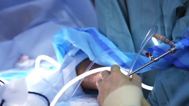 Sebészeti Beavatkozás Orvos Keze Gumikesztyűben Műtétet Végez Beteg Lábán Sebész — Stock videók