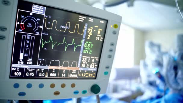 Beteg Állapotának Jelei Képernyőn Pulzusmérő Elmosódott Sebészeti Háttérrel Orvosi Monitorok — Stock videók