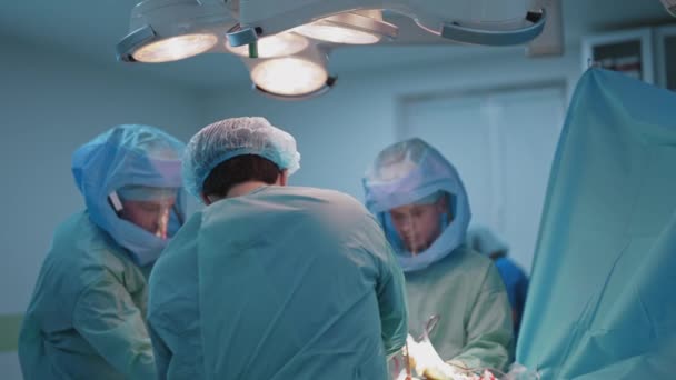 Χειρουργική Διαδικασία Κάτω Από Ιατρική Λάμπα Ομάδα Χειρουργών Μπλε Στολή — Αρχείο Βίντεο
