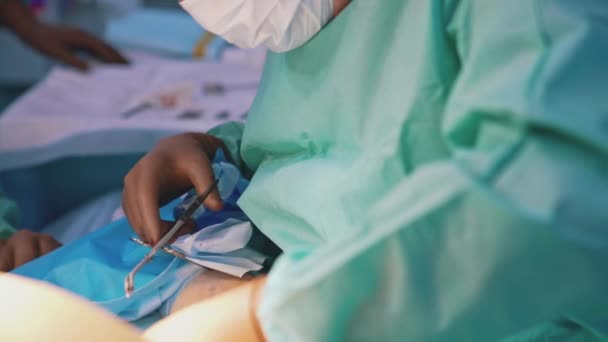 Orvos Plasztikai Műtétet Végez Sebész Kezei Kesztyűben Orvosi Műtéteket Végeznek — Stock videók