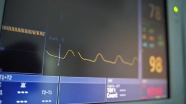 Kalp kardiyogramı ve ekranda rakamlar. Sarı çizgi siyah ekranda belli bir kalp atışında hareket eder. Dalgalı kardiyogram hareketi monitörde. Yakın plan..