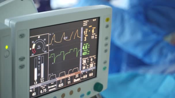 医療モニターのラインの動き 手術室で患者の心拍を示すグラフ 医療機器について クローズアップ — ストック動画