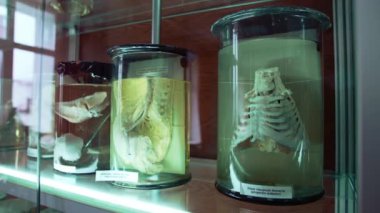 Tıp müzesinde insan iç organları. Formaldehit içeren cam tüplerdeki anatomik organlar..