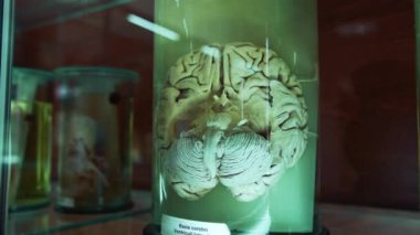 Tıp müzesindeki insan beyni modeli. Formalin içinde korunmuş iç organ. Serebrumun anatomik modeli laboratuvarda. Yakın plan..