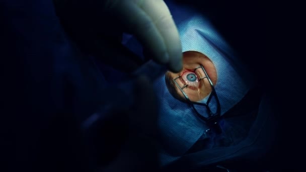 Chirurgie Oculaire Ophtalmologiste Opérant Œil Patient Opération Œil Salle Opération — Video