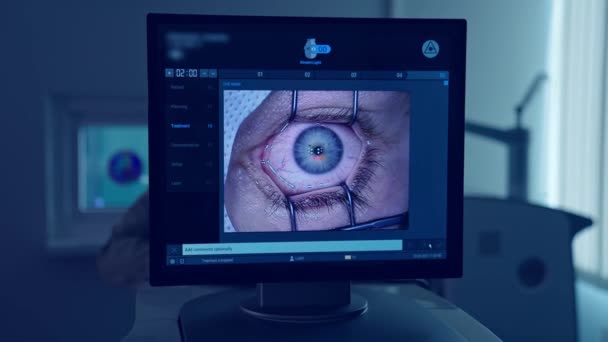 带有眼科手术的计算机监视器被显示出来了 手术时眼睛被擦掉了 屏幕上的眼睛激光治疗 后续行动 — 图库视频影像