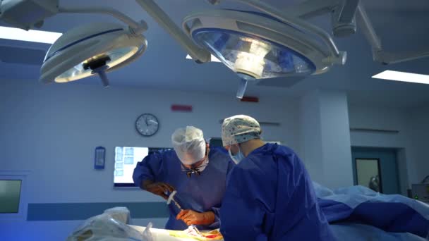 手術室の外科医のチームワーク 外科の専門家は明るいランプの下で操作を行います 専門医は手術中に外科用具を使用しています — ストック動画