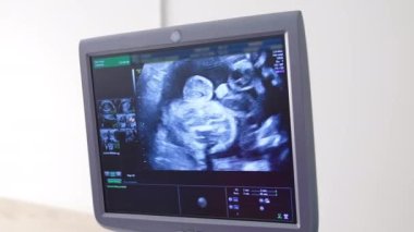 Ultrason monitöründe küçük bir bebek görünüyor. Ekranda gelecekteki bebeğin görüntüsü olan modern ultrason makinesinin görüntüsü. Hamileliğin gelişimi.