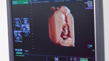 Monitördeki fetüs resimleri. Bilimsel analiz. Hamile bir kadının ultrasonografisi. Ultrason monitöründe hamile bir kadının karnında küçük bir bebek görülüyor..