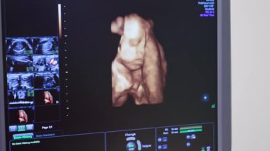 İnsan embriyosu kafasını ultrasona sokuyor. Ultrason monitörü hamile bir kadına ultrason uygulanırken bebek vücudunu gösteriyor..