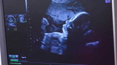 Hamile bir kadının ultrasonografisi. Minik bebek annesinin karnını çeviriyor. Anne karnındaki bebek ultrasonda hareket ediyor..