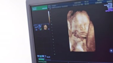Ultrasonda ekranda bir bebeğin renkli görüntüleri var. Hamile bir kadının ultrason işlemi sırasında gelecekteki çocuğun embriyosunu görüntüle.