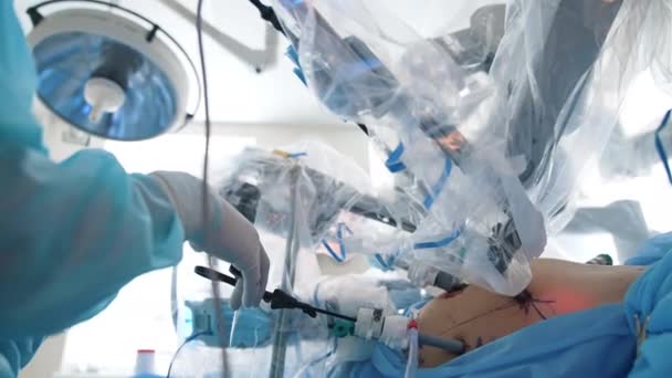 患者に手術を行うロボットアーム 外科医を支援する最小侵襲手術を行う現代の外科機器 クローズアップ — ストック動画