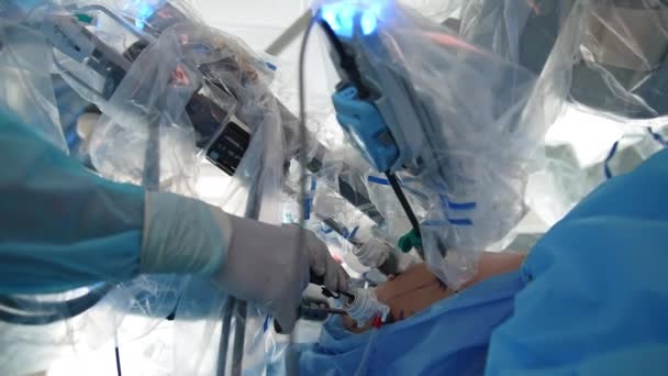 手術中の患者の腹部のロボット装置 ドクターは外科ロボットを使って手術を行う 患者の体内の医療用ロボットアーム クローズアップ — ストック動画