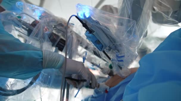 手術中のロボットマシンアーム 医師はロボット装置の助けを借りて手術をしている クリニックでロボットを介した医療活動 クローズアップ — ストック動画