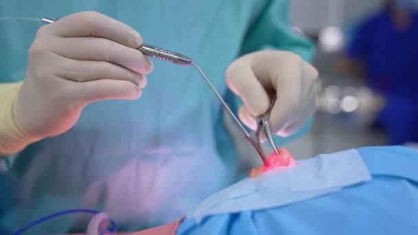 Orvos Orrműtétet Végez Modern Felszereléssel Sebész Keze Sebészeti Műszert Használ — Stock videók