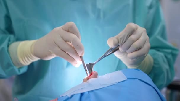 鼻からの手術 患者に鼻腔手術を行っている間 不妊手術器具を使用した外科医 クローズアップ — ストック動画