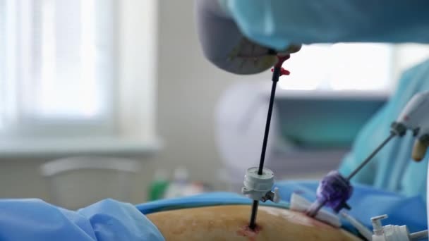 手术过程中医生手中的手术器械 使用现代医疗设备进行外科手术的医疗专家小组 — 图库视频影像