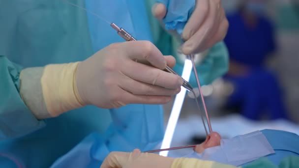 患者の鼻からの手術 無菌手袋の医師の手は 特別な器具で顔に手術をしている クローズアップ — ストック動画