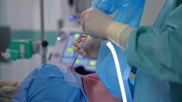 Χειρουργείο Στη Μύτη Γιατρός Χειρίζεται Ασθενή Ειδικά Αποστειρωμένα Ιατρικά Εργαλεία — Αρχείο Βίντεο