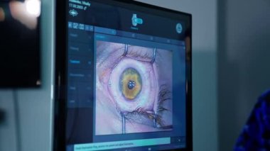 Lazer düzeltmesi sırasında bir gözün bilgisayar görüntüsü. Oftalmik Klinik, Cerrahi