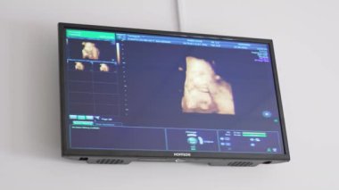 Bir annenin rahminde ultrason bebeği. Hamile bir kadının ultrasonu. Bilimsel analiz