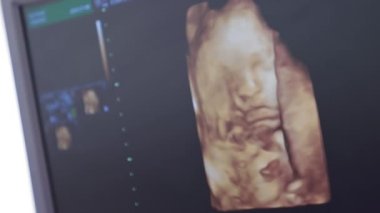 Anne karnında bebeğin ultrasonu. Hamilelik ve Sağlık Hizmetleri konsepti. Doğum Öncesi Gösterim.