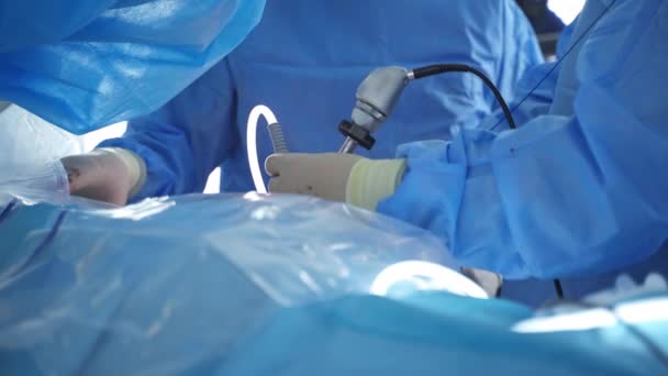 Modern Felszerelés Műtőben Csapatsebész Műtőben Sebész Műtőben Sebészeti Felszereléssel — Stock videók