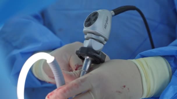 Processen För Operation Med Hjälp Medicinsk Utrustning Kirurg Operationssal Med — Stockvideo