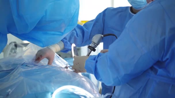 Orvosok Egy Csoportja Műtétet Végez Egy Betegen Orvosi Egyenruhás Sebészek — Stock videók