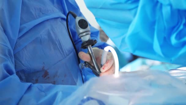 使用医疗设备进行外科手术的过程 手术室里的外科医生 带有外科设备 — 图库视频影像