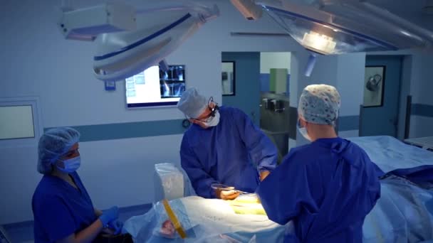 Хирурги Работают Операционной Группа Хирургов Операционной Хирургическим Оборудованием — стоковое видео