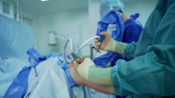 外傷手術のプロセス 手術装置を備えた手術室の外科医のグループ — ストック動画