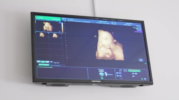 Bebé Con Ultrasonido Útero Una Madre Ultrasonido Mujer Embarazada Análisis — Vídeos de Stock