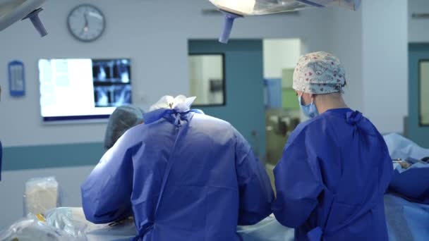 Хирурги Работают Отделении Скорой Помощи Современные Технологии Нейрохирургии — стоковое видео