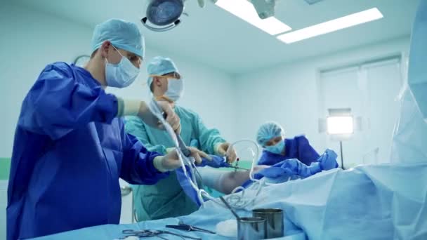Tratament Urgență Chirurgical Echipa Chirurgi Care Lucrează Împreună Sala Operații — Videoclip de stoc