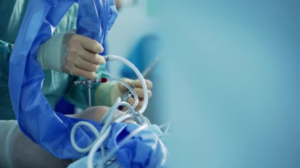 近代的な手術機器が稼働している 緊急区で働くチーム外科医 — ストック動画
