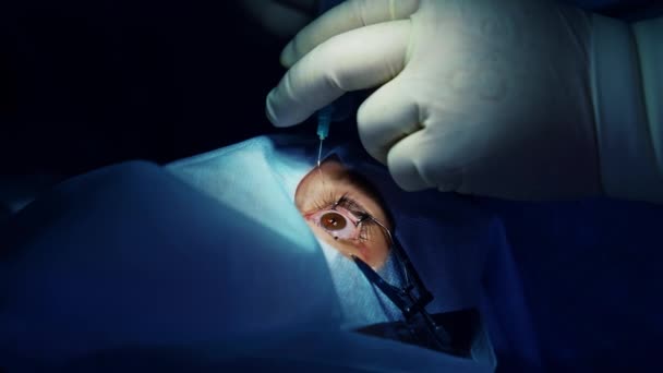 Moderní Technologie Korekce Očí Nemocnici Oko Pacienta Pod Sterilním Krytem — Stock video
