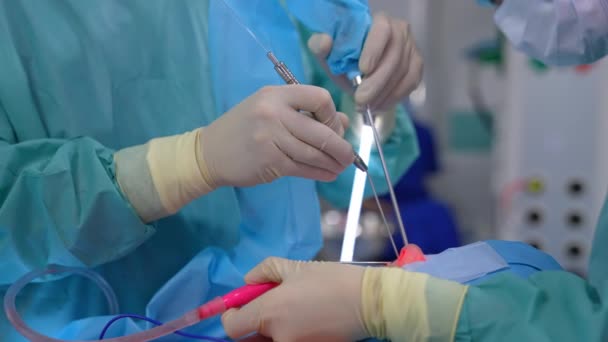 Operazione Medica Ospedaliera Professionale Neurochirurgia Trattamento Sanitario — Video Stock