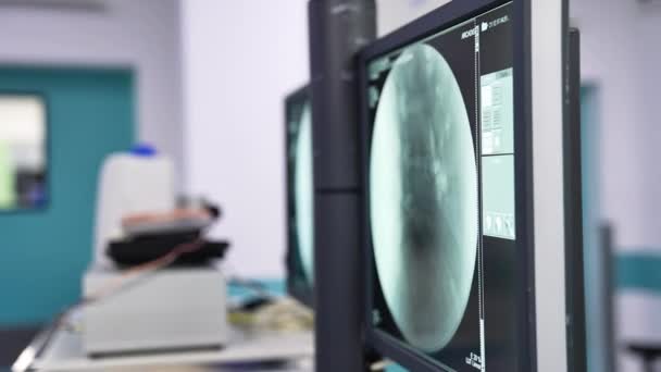 显示脊柱X光的屏幕 一个准备动手术的现代手术室的模糊图像 背景下在外科工作的人 — 图库视频影像