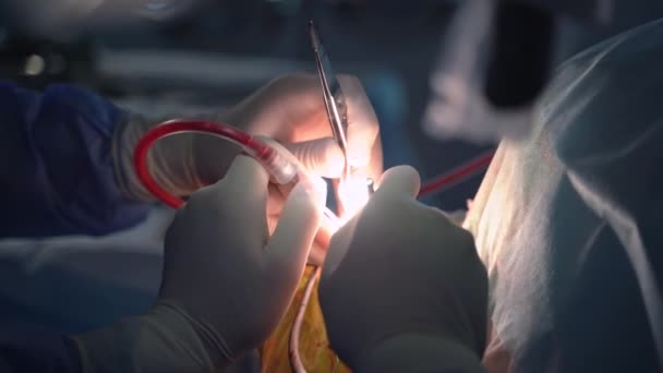 Hände Von Ärzten Handschuhen Die Die Operation Mit Speziellen Werkzeugen — Stockvideo