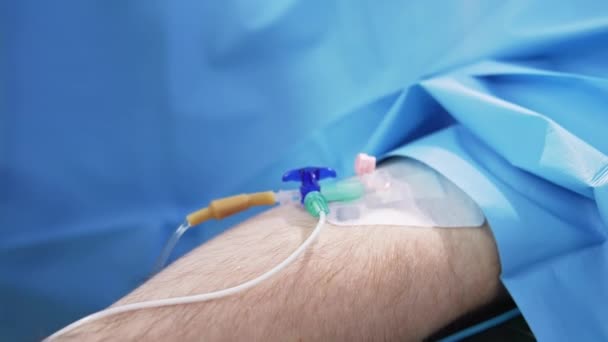 Mão Homem Com Tubos Tubos Injeção Anexados Gotejamento Paciente Deitado — Vídeo de Stock
