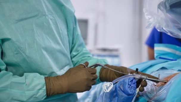手術用器具を使用した茶色のゴム手袋のドクターの手 外科医は クリーニングのアシスタントにツールを渡します クローズアップ — ストック動画