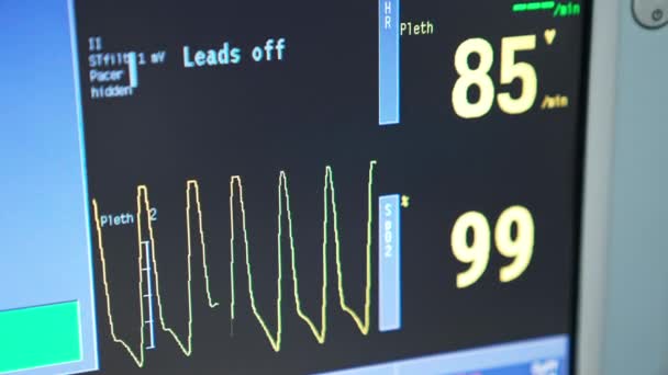 Schwarzer Bildschirm Eines Monitors Mit Kurvenlinie Des Pulses Des Patienten — Stockvideo