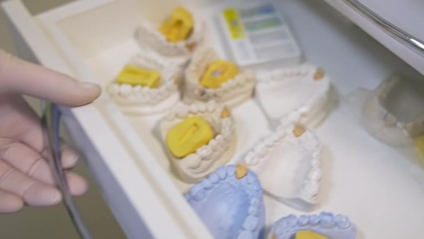 Kol Saati Olan Eldivenli Bir Alçı Diş Modelleriyle Dolu Bir — Stok video