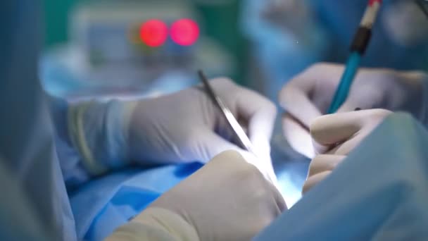 Användning Avancerad Utrustning Modern Kirurgi Kirurger Använder Metallverktyg Samt Elektrisk — Stockvideo